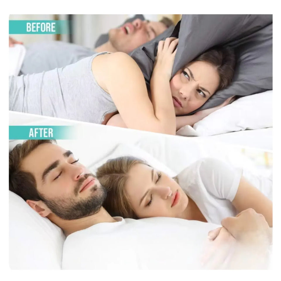 Clip Nasal Antirronquidos (Pack x4) – Duerme Mejor, Tú y Tu Pareja