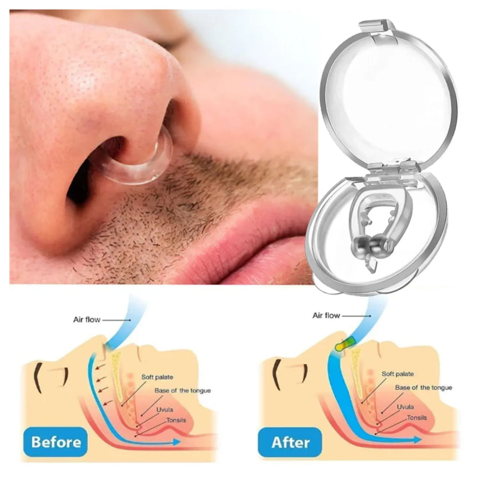 Clip Nasal Antirronquidos (Pack x4) – Duerme Mejor, Tú y Tu Pareja