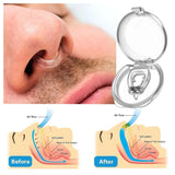 Clip Nasal Antirronquidos (Pack x4) – Duerme Mejor, Tú y Tu Pareja